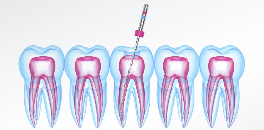 Endodonzia